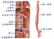 食管腐蚀伤