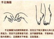 维生素D缺乏性手足抽搐症