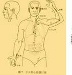 军刀综合征 军刀综合征
