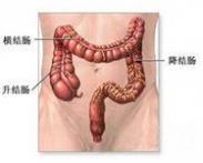 结肠闭锁
