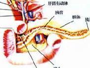 急性出血坏死型胰腺炎