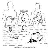 间插血吸虫病 间插血吸虫病