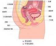 肺炎衣原体感染 肺炎衣原体感染