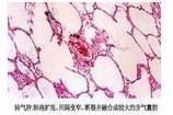 老年人呼吸性酸中毒 老年人呼吸性酸中毒