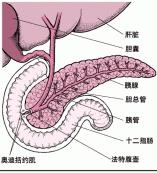 老年人急性胰腺炎