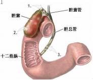 溃疡病急性穿孔