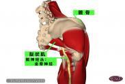 挤压综合征 挤压综合征