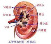 肾性尿崩症 肾性尿崩症