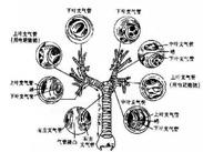 小叶性肺炎 小叶性肺炎