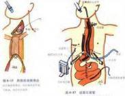 强碱类中毒
