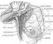 胸壁深部软组织感染