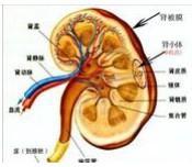 近端肾小管性酸中毒
