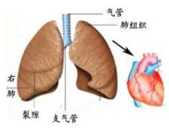 肺心病 肺心病