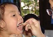小颌畸形综合征