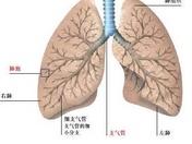 小儿支气管扩张 小儿支气管扩张