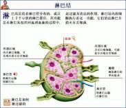重链病 重链病