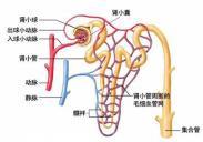 IgA肾病