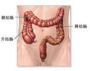 血吸虫肠病 血吸虫肠病