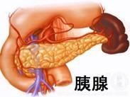 慢性胰腺炎