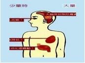 小儿呼吸衰竭 小儿呼吸衰竭