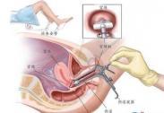 侵袭性指趾乳头状腺癌
