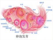 卵巢纤维组织来源肿瘤 卵巢纤维组织来源肿瘤