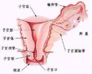 女性生殖器先天性畸形