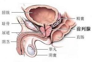 前列腺增生