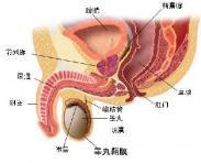 男性生殖器畸形 男性生殖器畸形