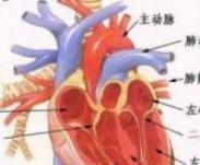 加速性房性逸搏心律 加速性房性逸搏心律