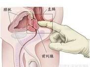 泌尿生殖系损伤