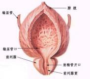 尿道炎