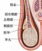 鞘膜积液 鞘膜积液