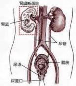 尿路刺激征