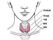 慢性纤维性甲状腺炎