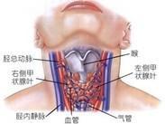 慢性淋巴细胞性甲状腺炎