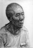 老年人慢性淋巴细胞白血病 老年人慢性淋巴细胞白血病