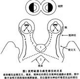 无功能垂体腺瘤