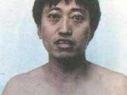甲状腺功能异常伴发的精神障碍