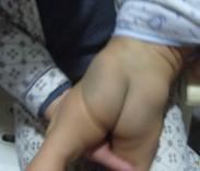 血小板减少症 血小板减少症
