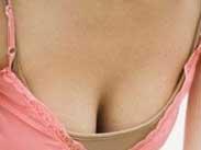 成人型女性乳房肥大症 成人型女性乳房肥大症