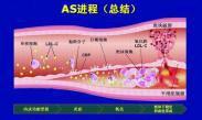 获得性高脂蛋白血症
