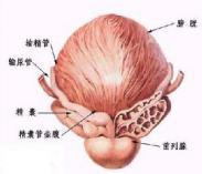 精囊结石