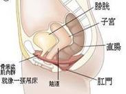 膀胱脱垂