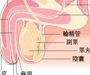 急性附睾炎