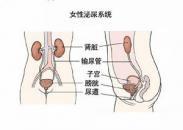 女性膀胱颈梗阻 女性膀胱颈梗阻