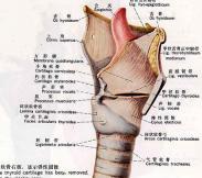 气管肿瘤 气管肿瘤