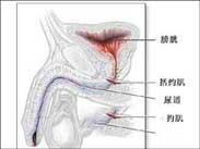 阴茎结核 阴茎结核