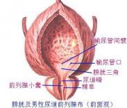 出血性膀胱炎