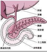 胰腺外伤